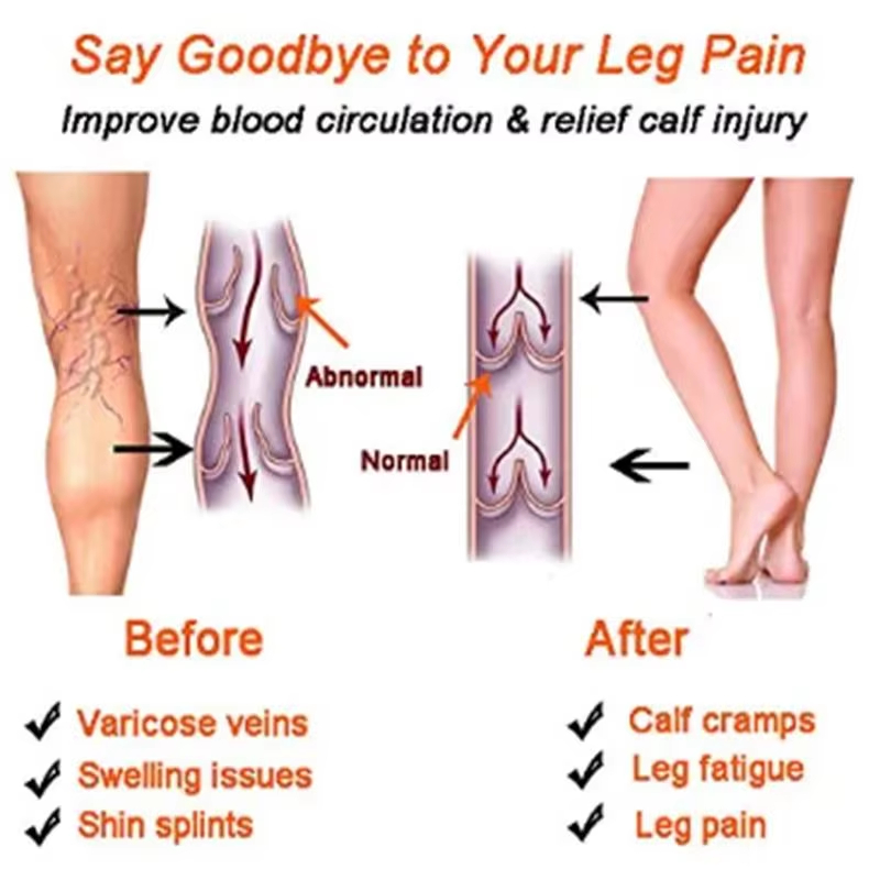 Women Compression Socks Slimmi - Compression Sock Medical recension och pris